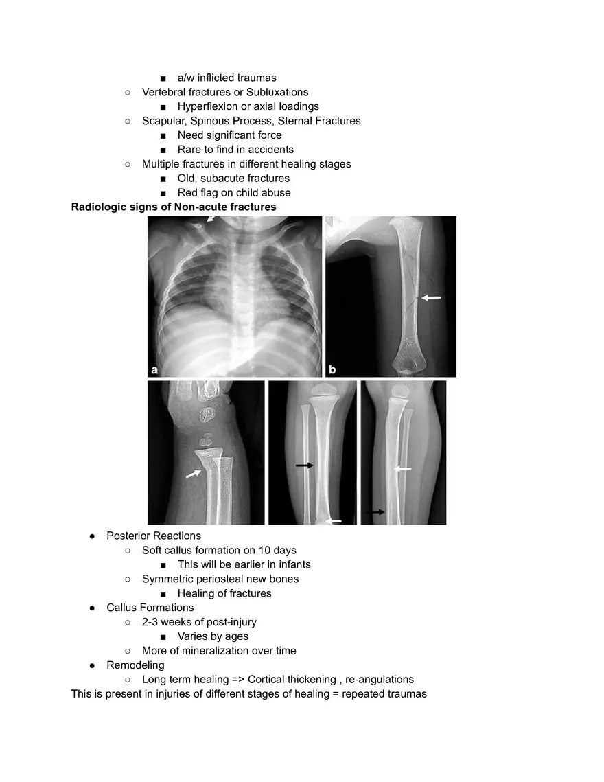 Child abuse: Non-acute fracture - Page 2