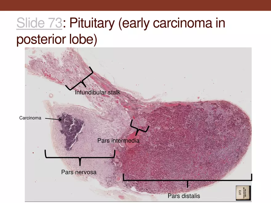 Endocrine System Part 1 - Page 11
