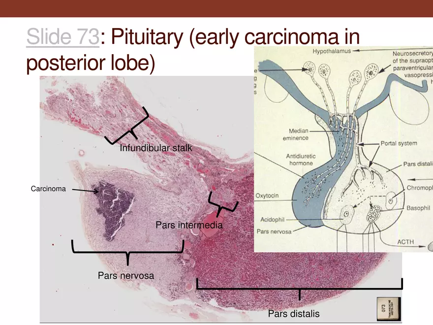 Endocrine System Part 1 - Page 12