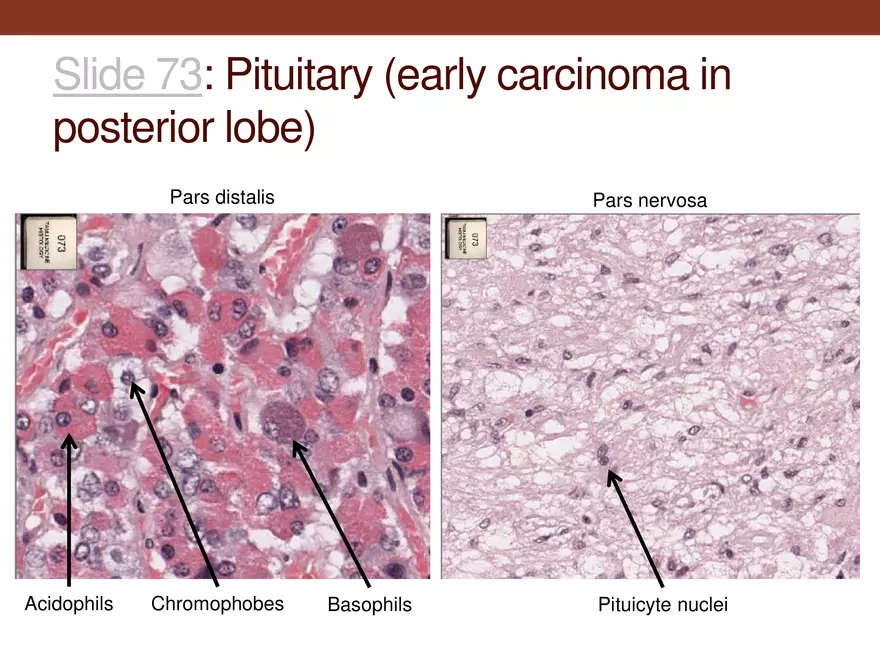 Endocrine System Part 1 - Page 16