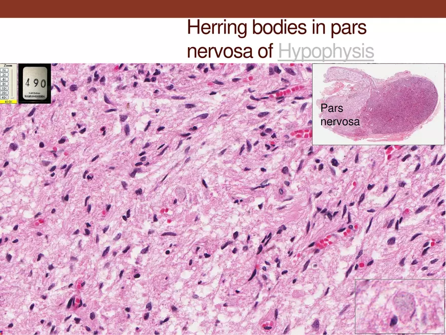 Endocrine System Part 1 - Page 17