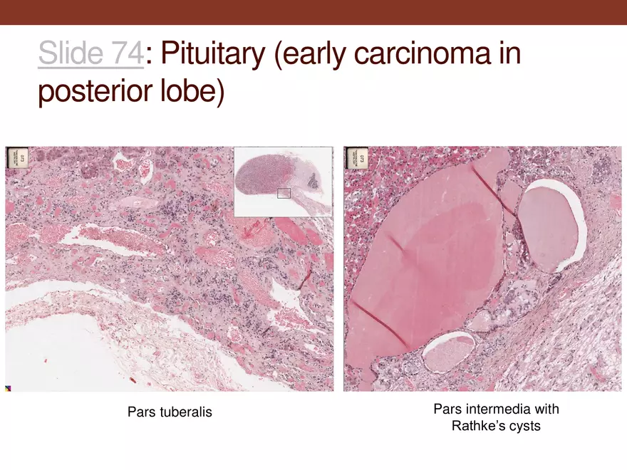 Endocrine System Part 1 - Page 19