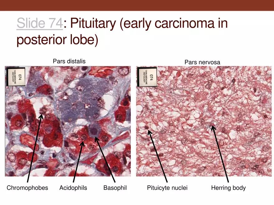 Endocrine System Part 1 - Page 21