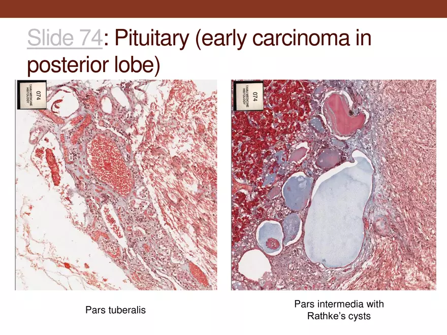 Endocrine System Part 1 - Page 22