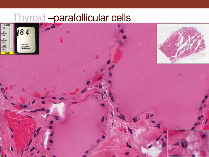 Endocrine System Part 1 - Page 26