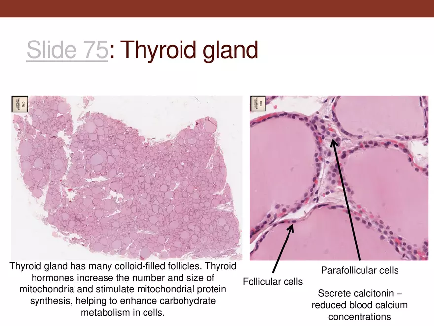 Endocrine System Part 1 - Page 29