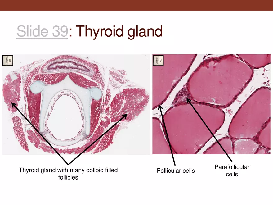 Endocrine System Part 1 - Page 30