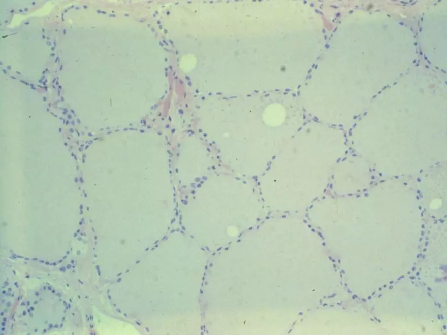 Endocrine System Part 1 - Page 31