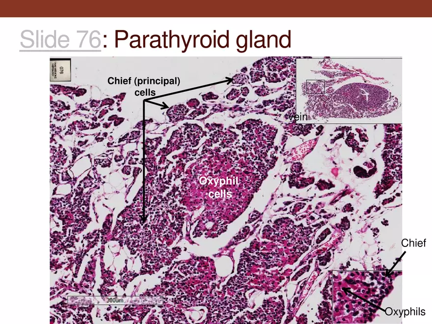 Endocrine System Part 1 - Page 36