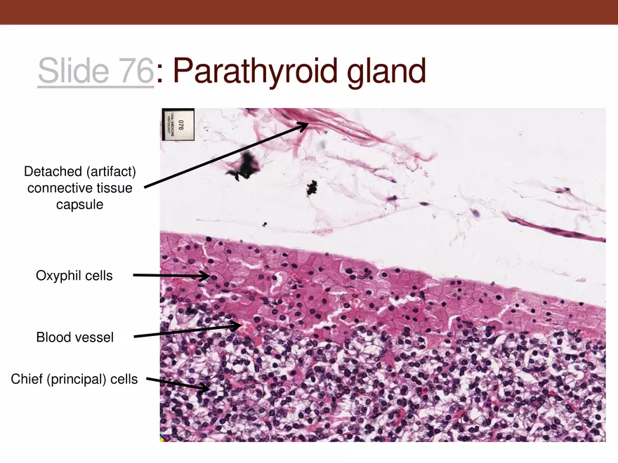 Endocrine System Part 1 - Page 37