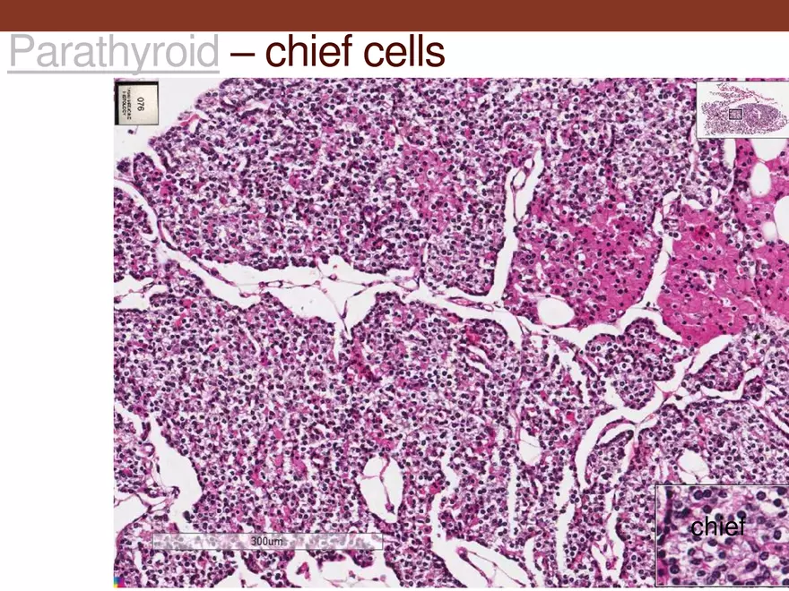 Endocrine System Part 1 - Page 39