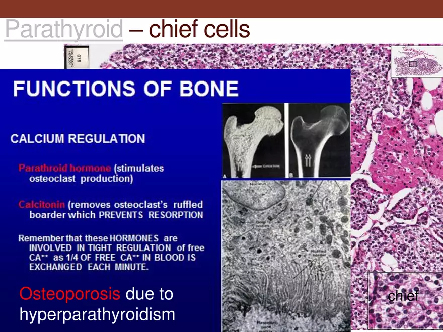 Endocrine System Part 1 - Page 40