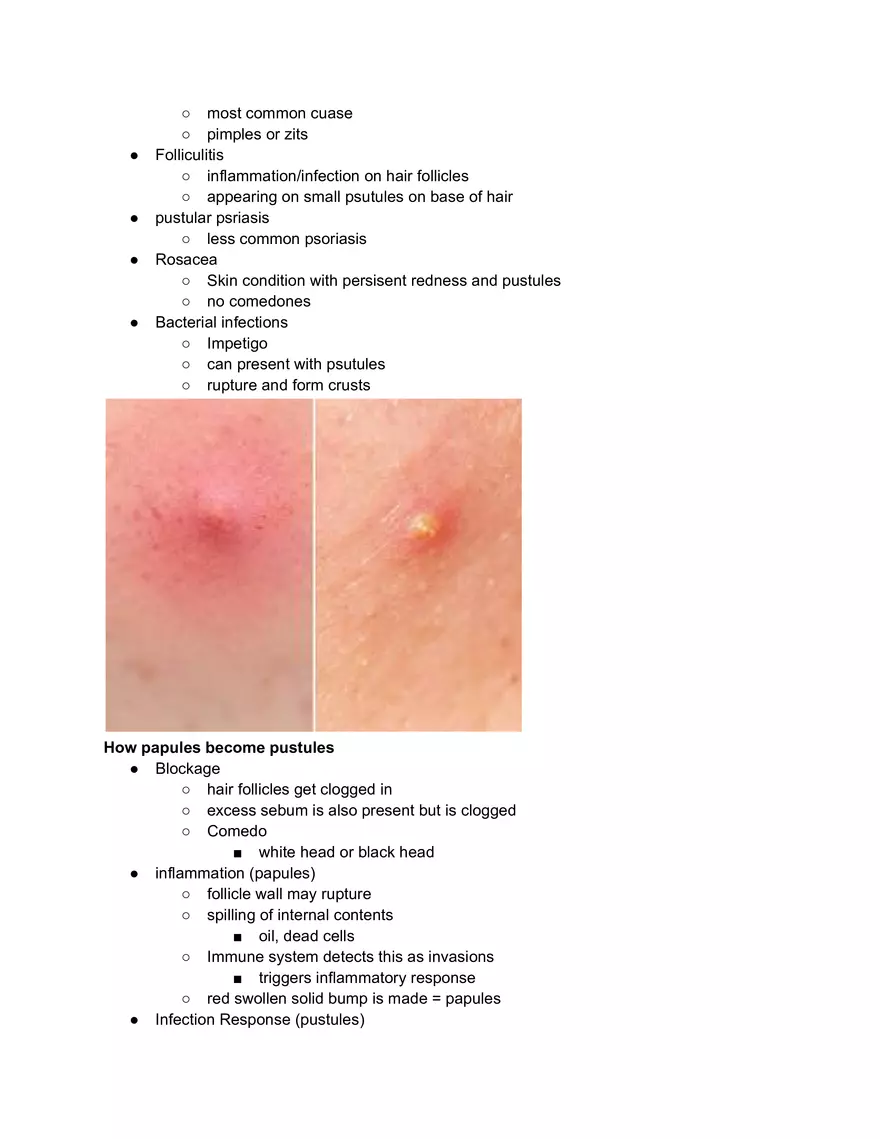 Papules and Pustules - Page 2