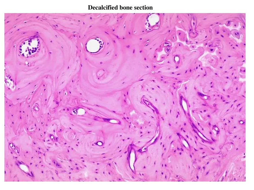 Bone Tissue - Page 56
