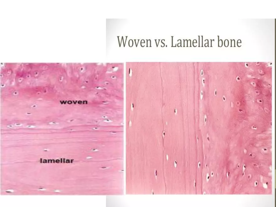 Bone Tissue - Page 60