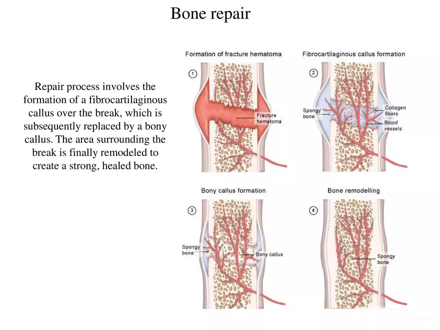 Bone Tissue - Page 63