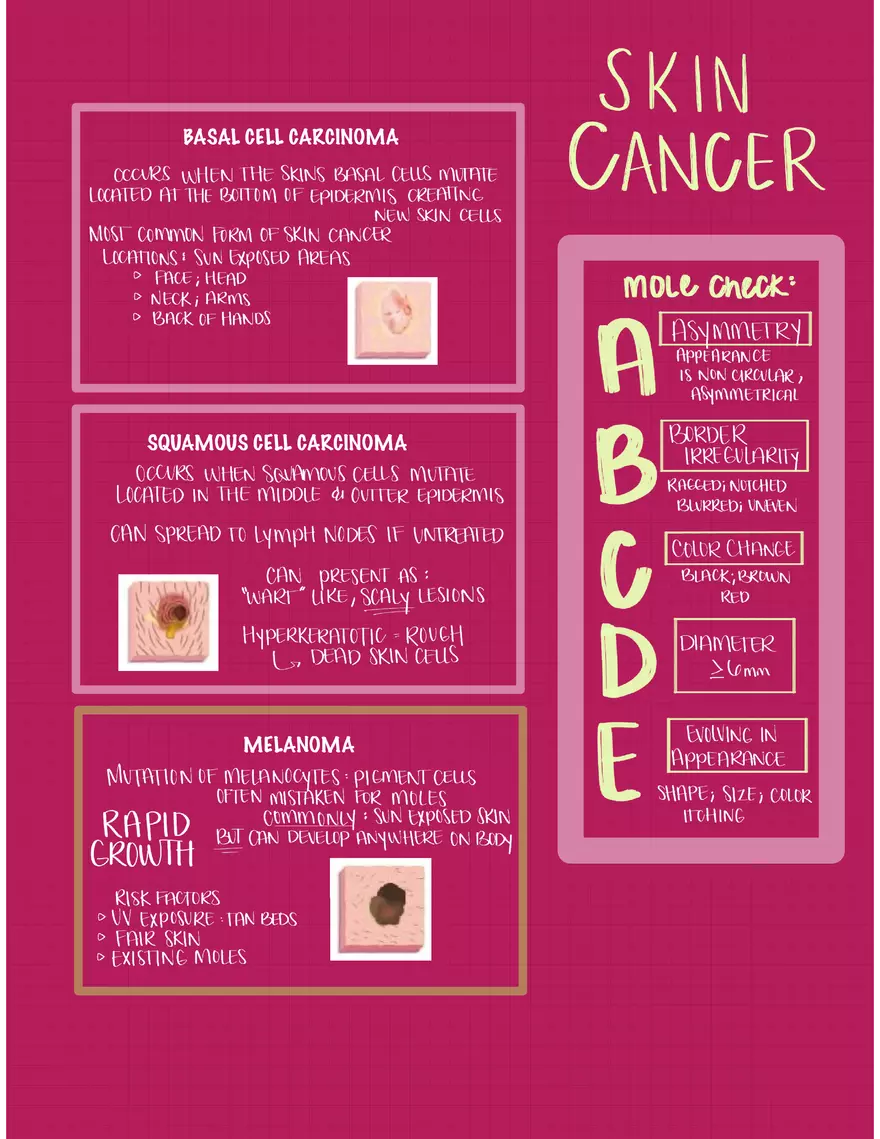 Easy Flash Cards Basal Cell Carcinoma - Page 1
