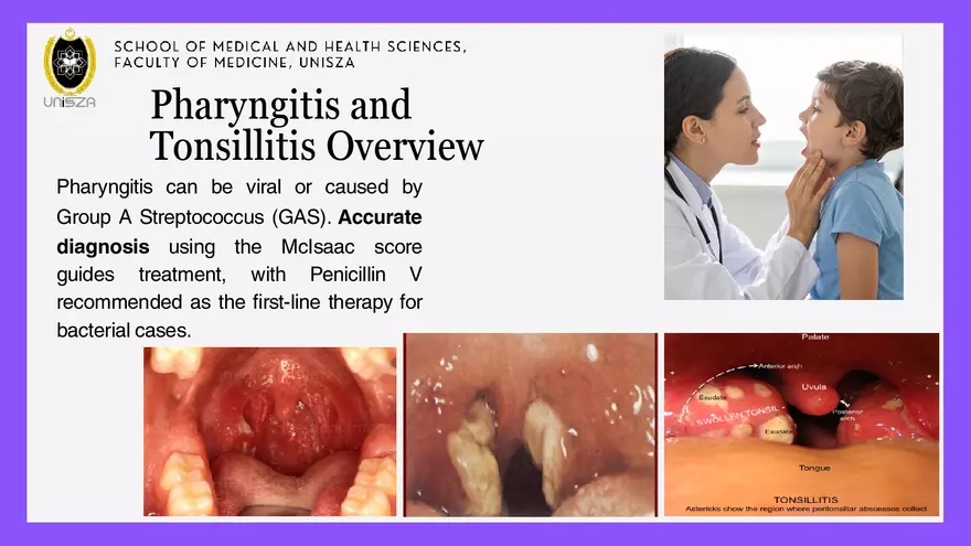 Presentation - Upper Respiratory Tract Infections - Page 19