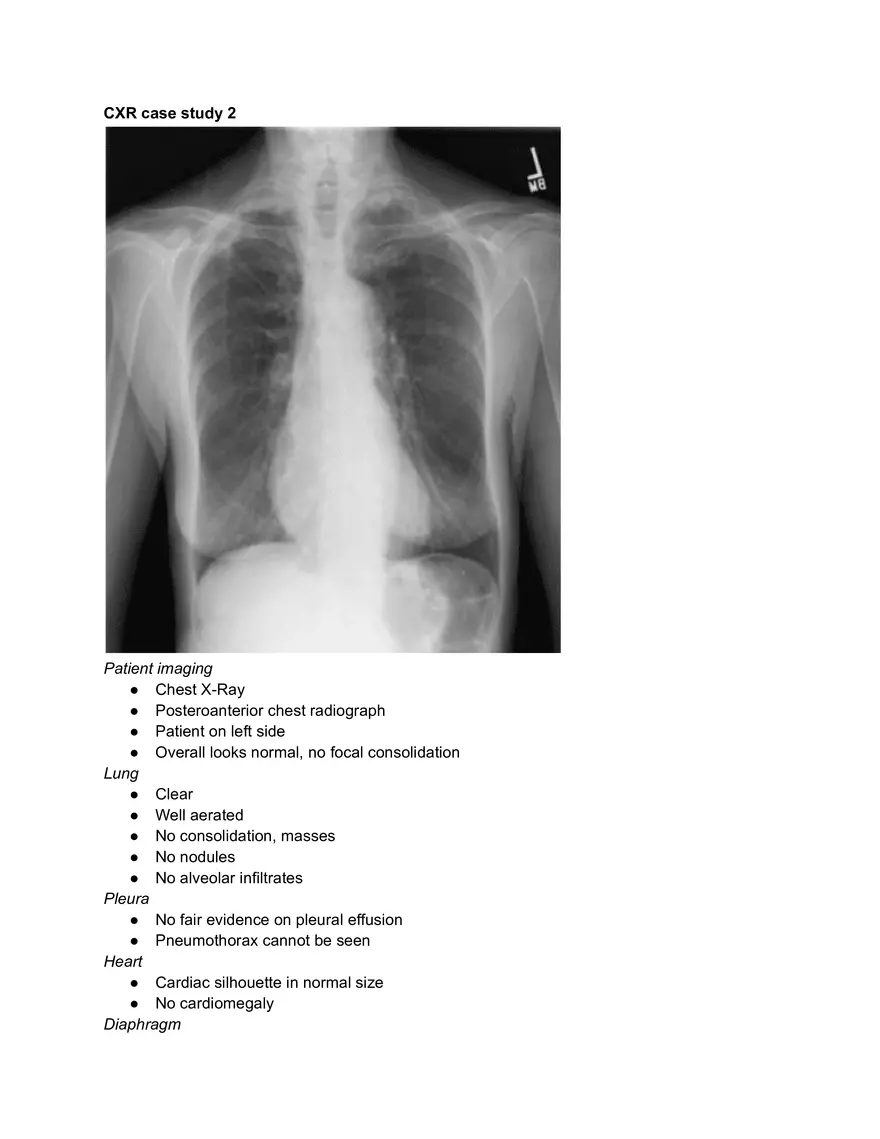 Chest X-ray (CXR) - Page 8