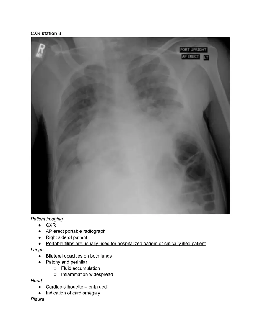 Chest X-ray (CXR) - Page 10