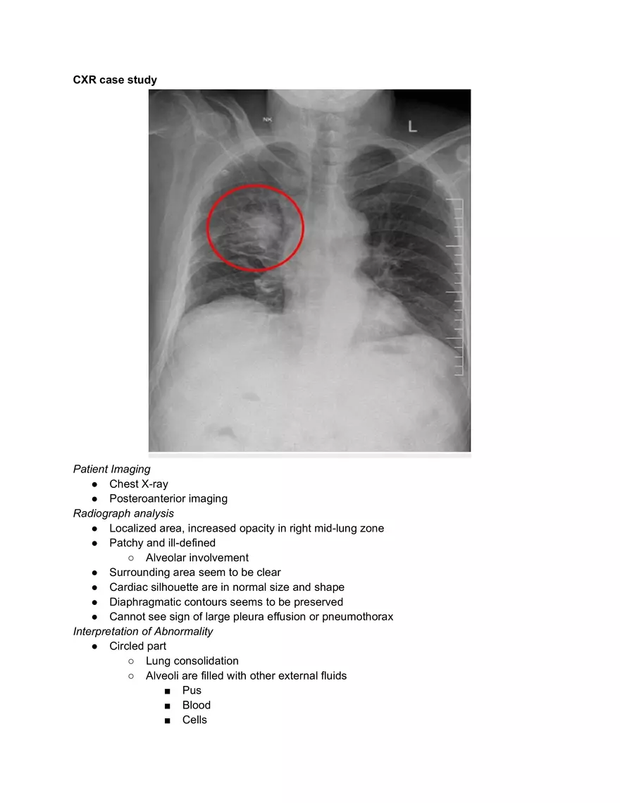 Chest X-ray (CXR) - Page 5
