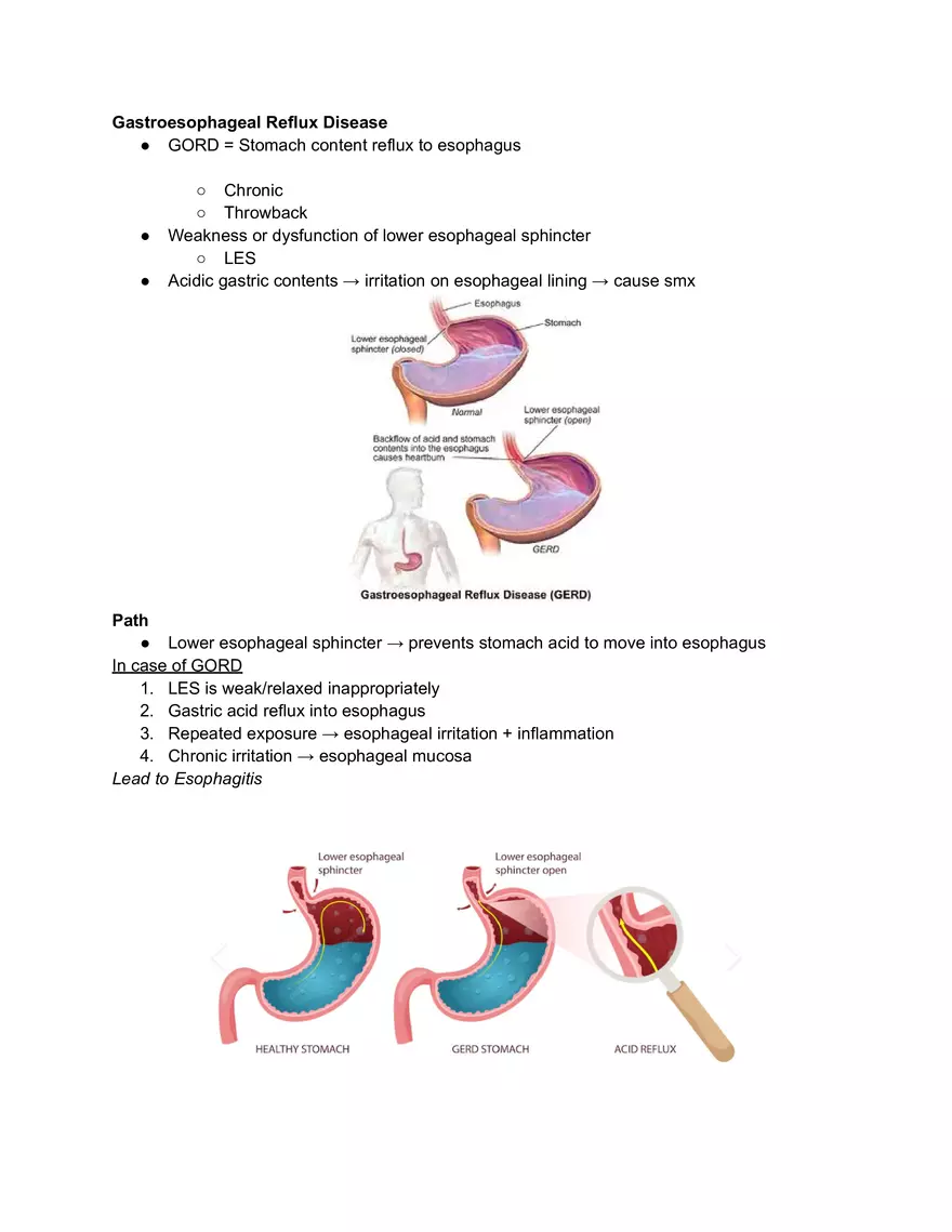 Gastroesophageal Reflux Disease - Page 1