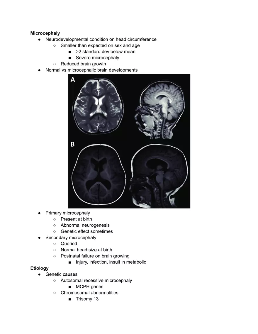 Microcephaly - Page 1