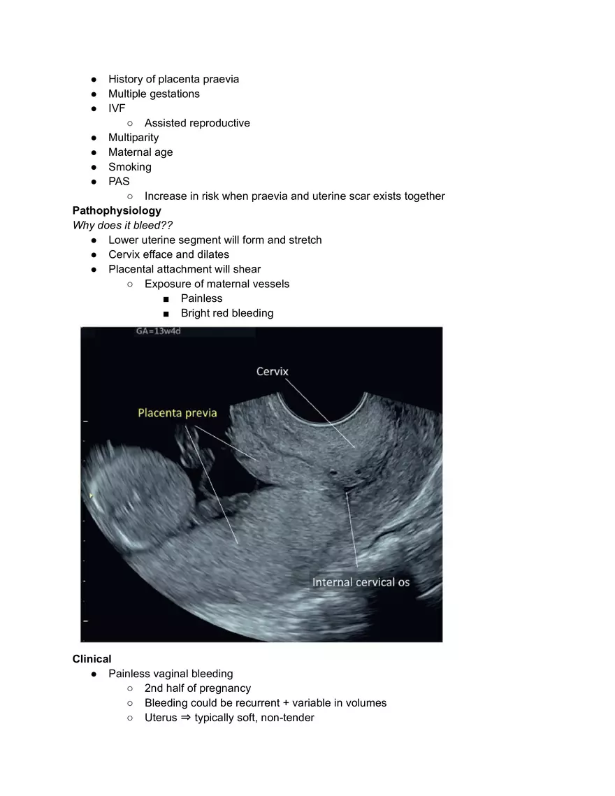 Placenta Praeiva - Page 2