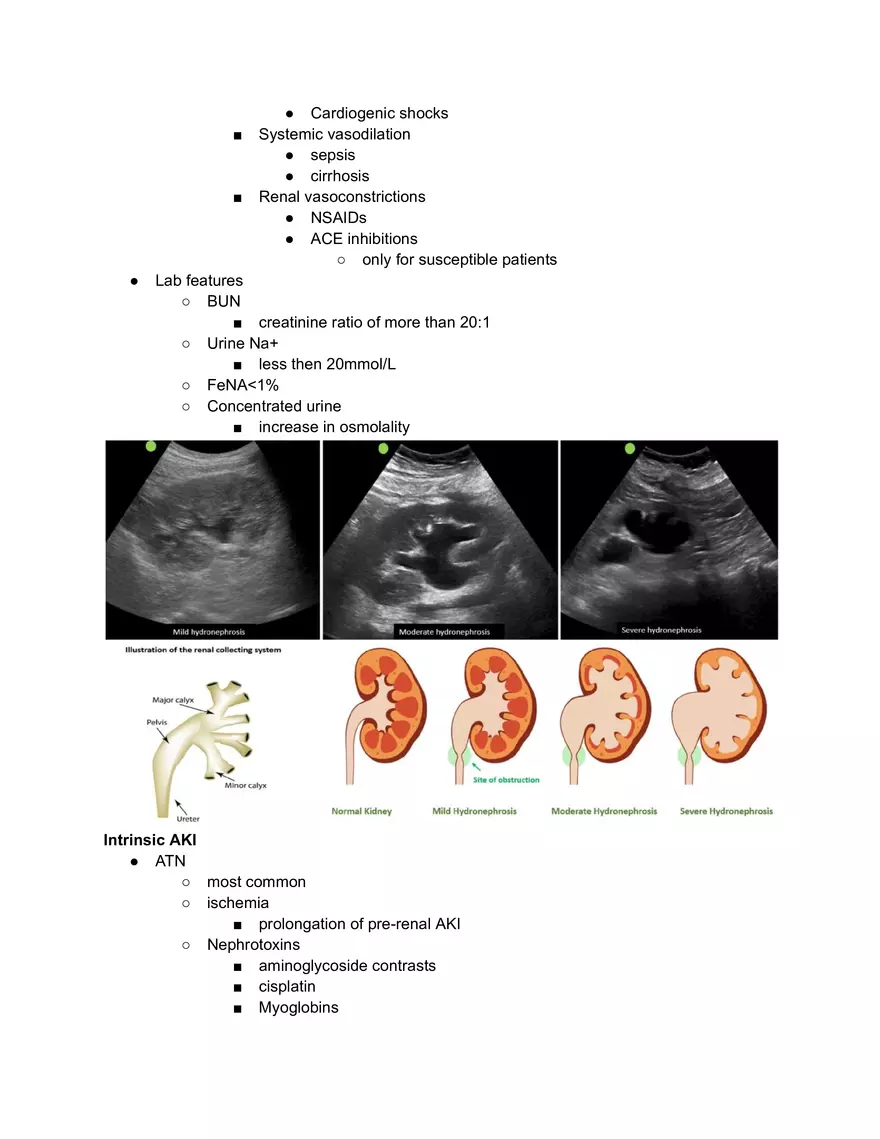 AKI - Acute Kidney Injury - Page 2