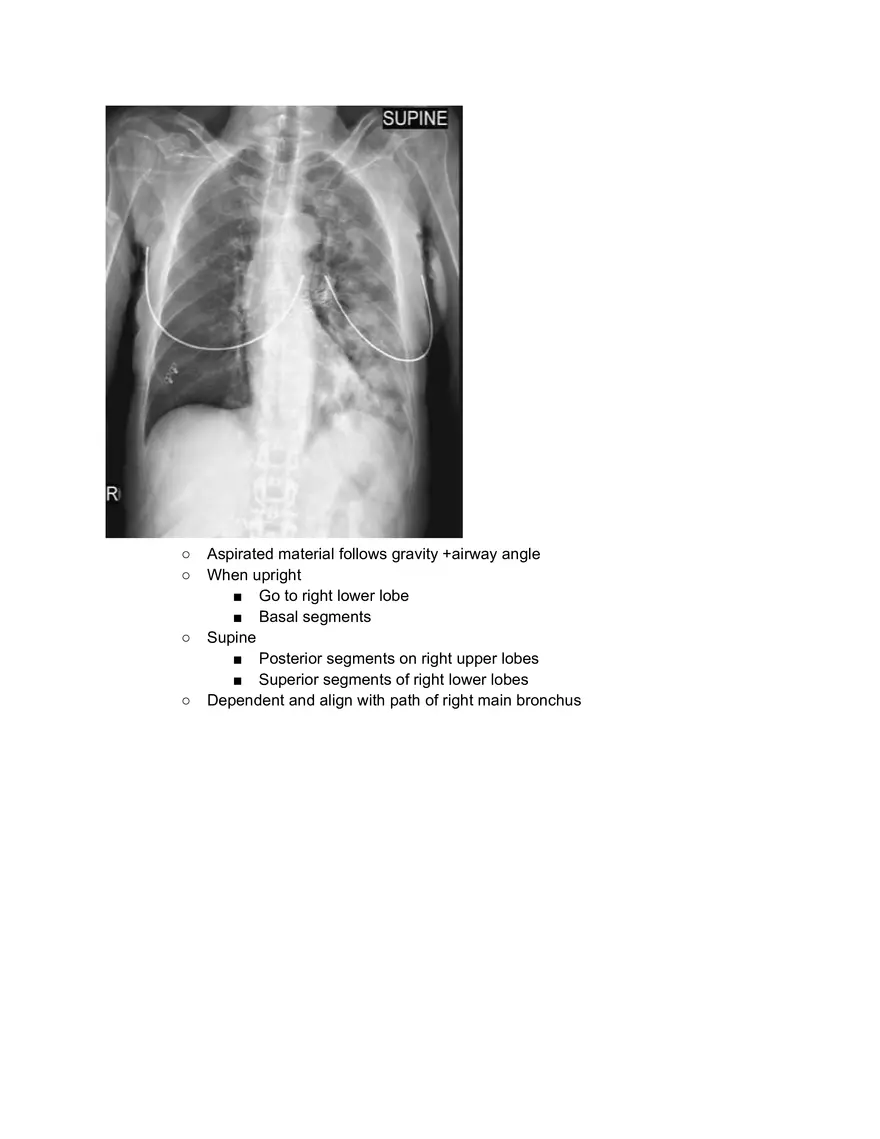 Pleural Procedure Anatomy - Page 5