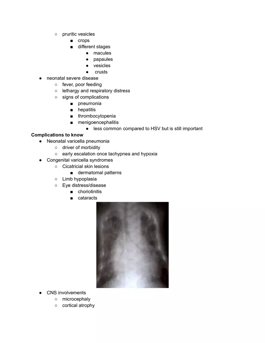 VZV Infection - Page 2
