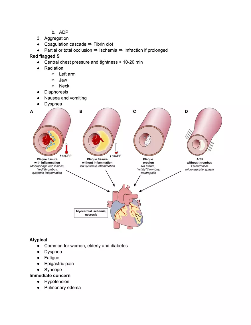 Coronary Artery Disease - Page 5