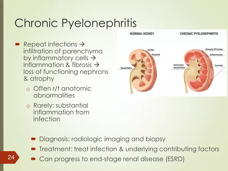 Renal and Urologic Problems - Page 17