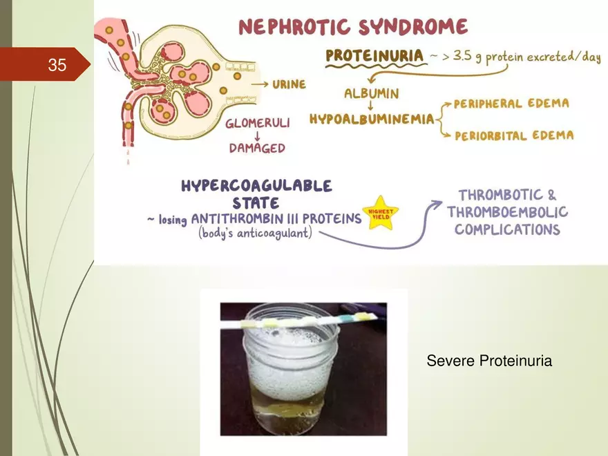 Renal and Urologic Problems - Page 29