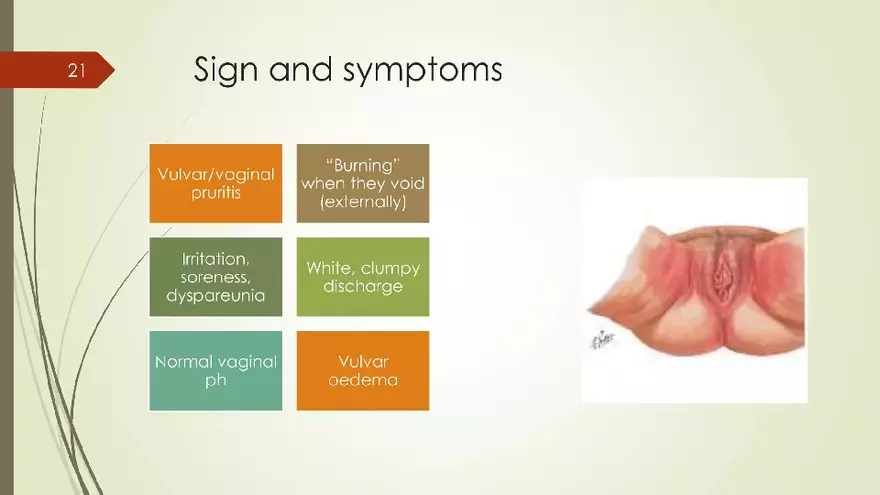 Genital Infection in Gynecology - Page 14