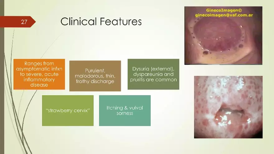 Genital Infection in Gynecology - Page 20