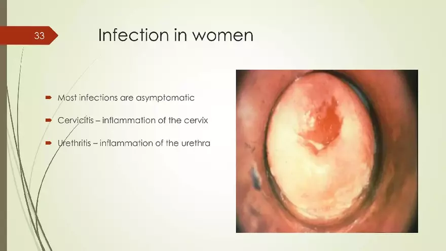 Genital Infection in Gynecology - Page 27