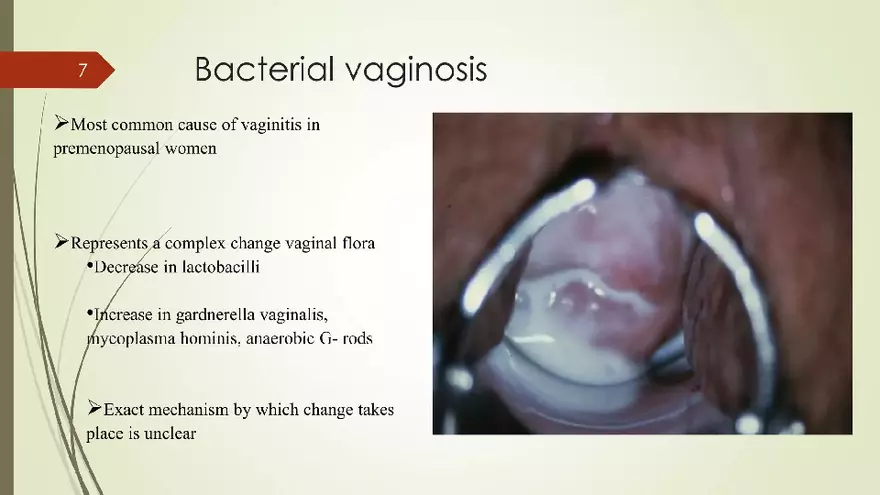 Genital Infection in Gynecology - Page 57