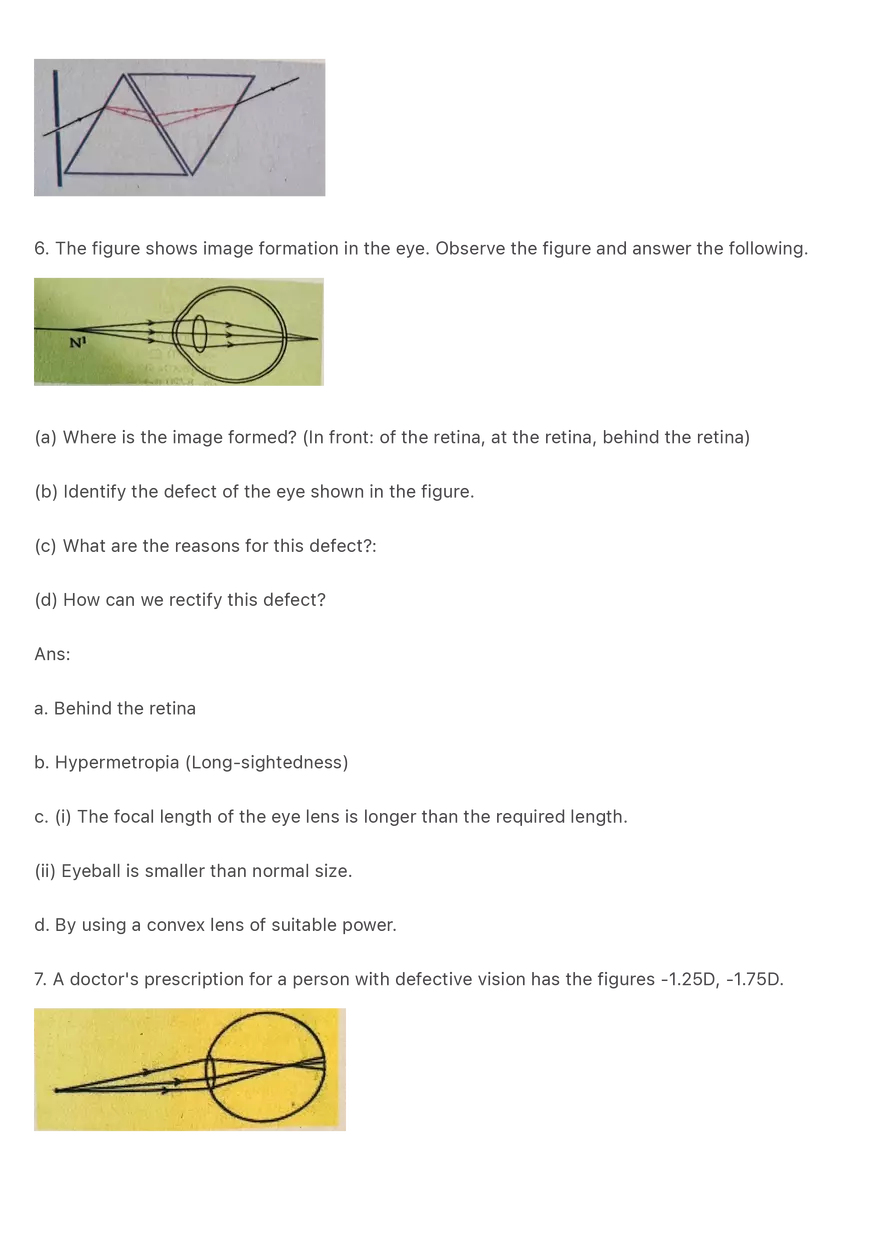 Question and Answers on the Topic Human Eye - Page 3