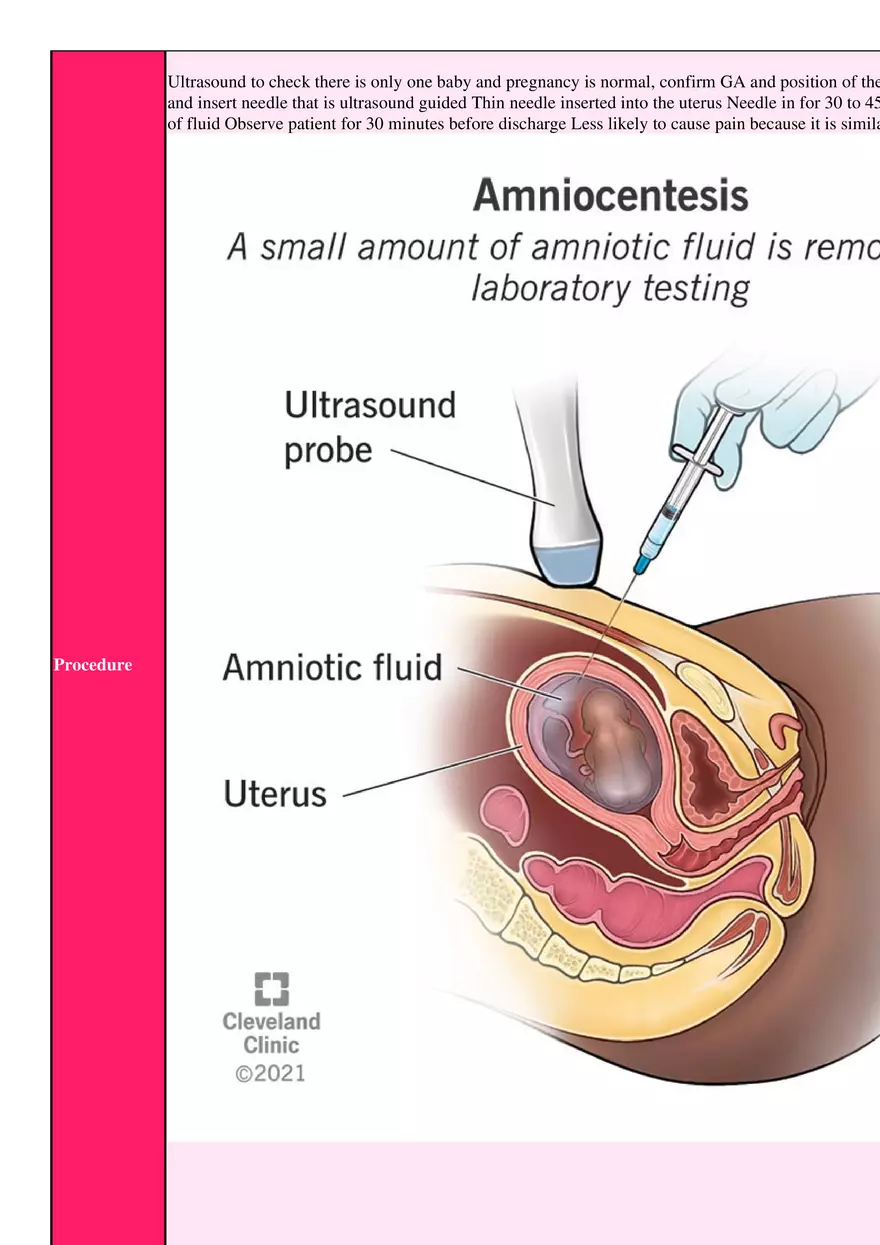Amniocentesis Basic Info - Page 2