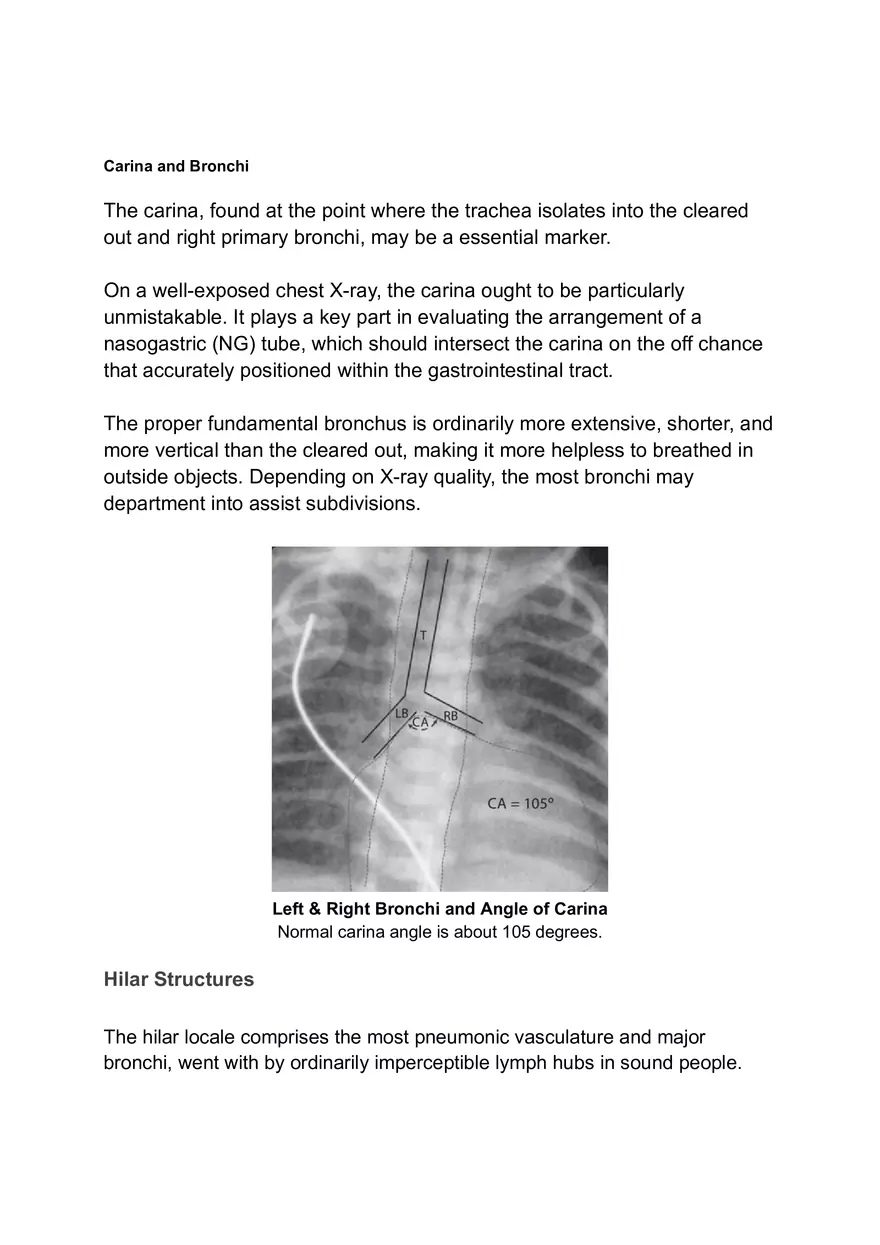 ABCDE Approach of Xray Interpretation - Page 7