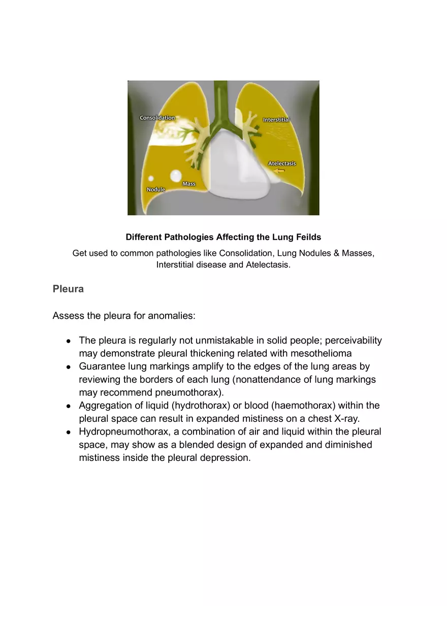 ABCDE Approach of Xray Interpretation - Page 10