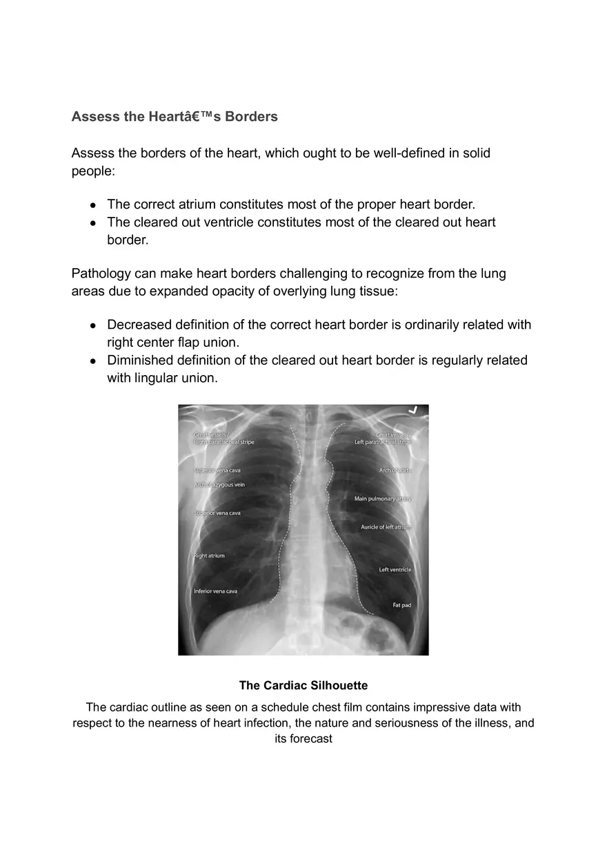 ABCDE Approach of Xray Interpretation - Page 13