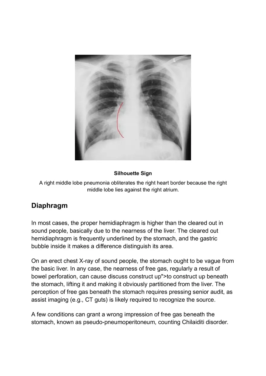 ABCDE Approach of Xray Interpretation - Page 14