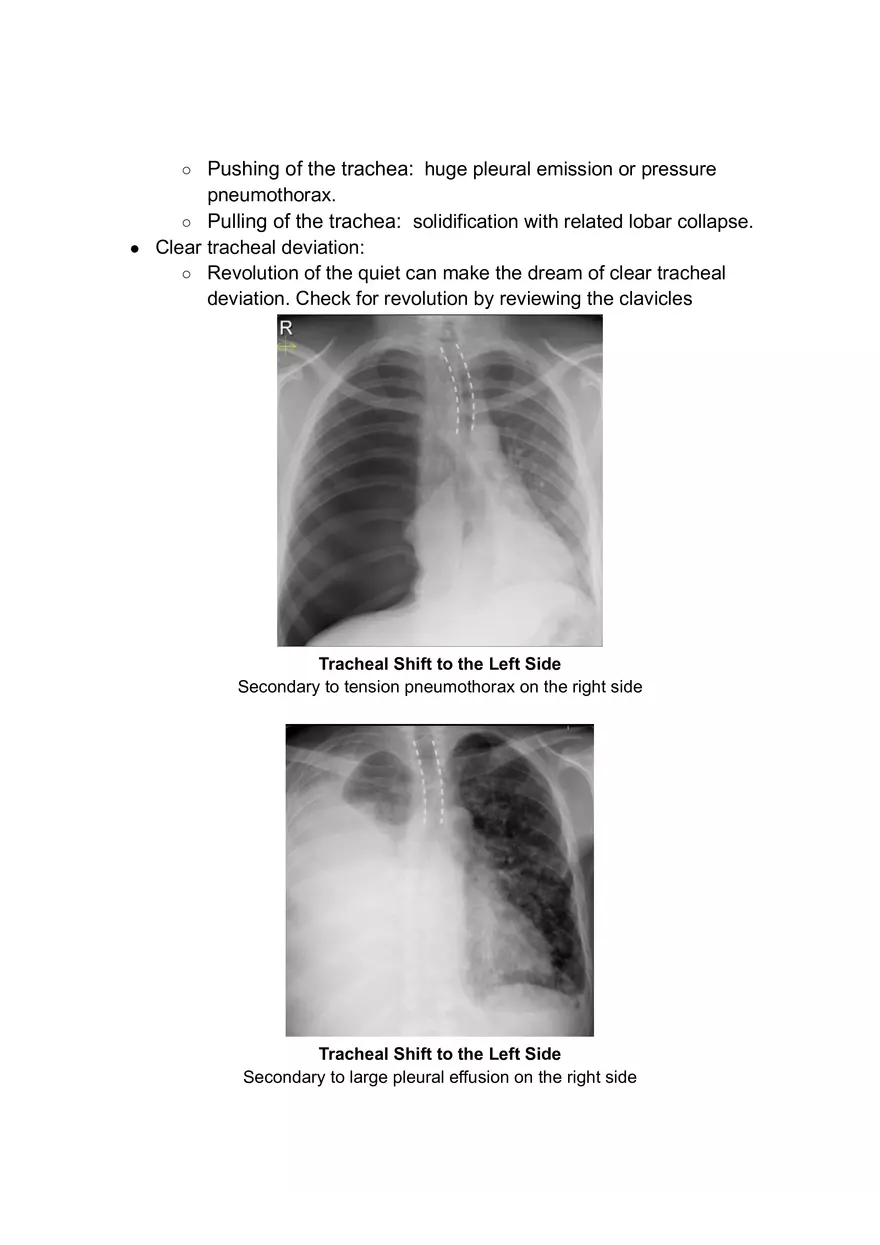 ABCDE Approach of Xray Interpretation - Page 2