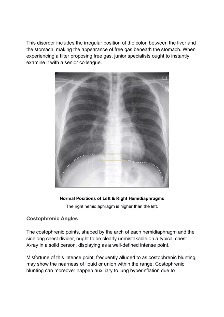 ABCDE Approach of Xray Interpretation - Page 3