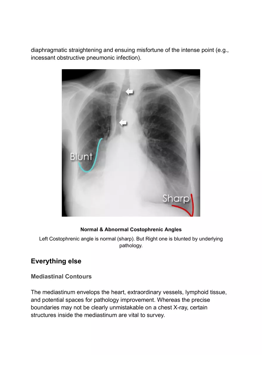 ABCDE Approach of Xray Interpretation - Page 4