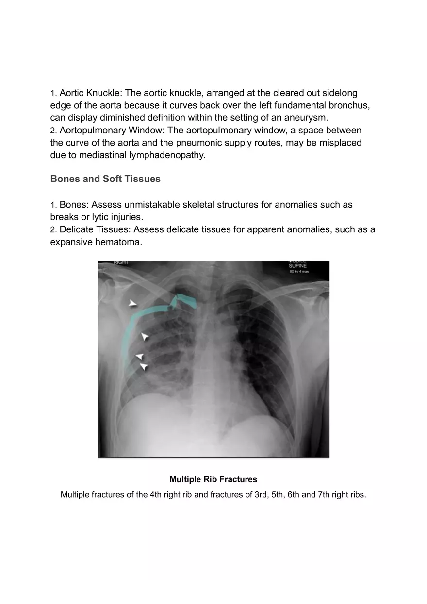 ABCDE Approach of Xray Interpretation - Page 5