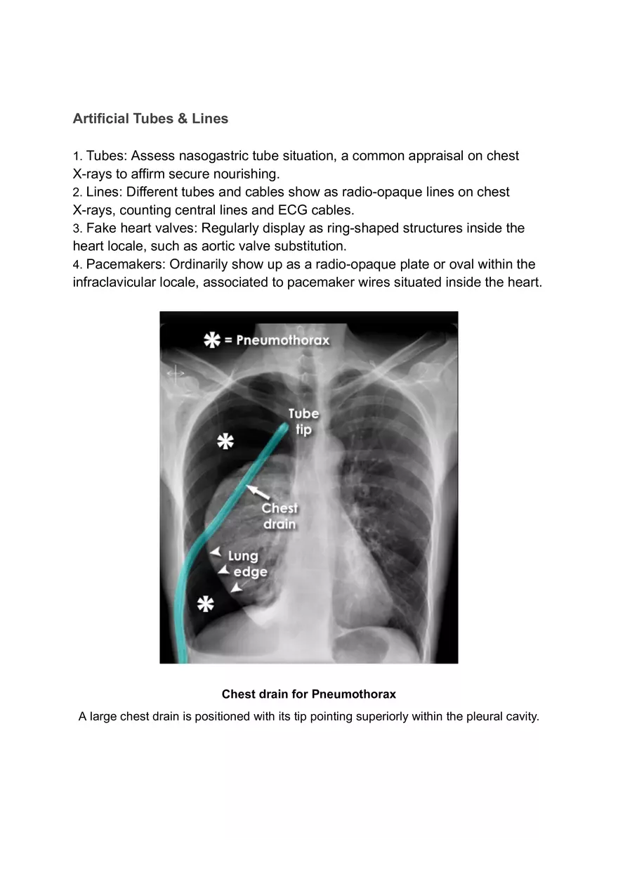 ABCDE Approach of Xray Interpretation - Page 6