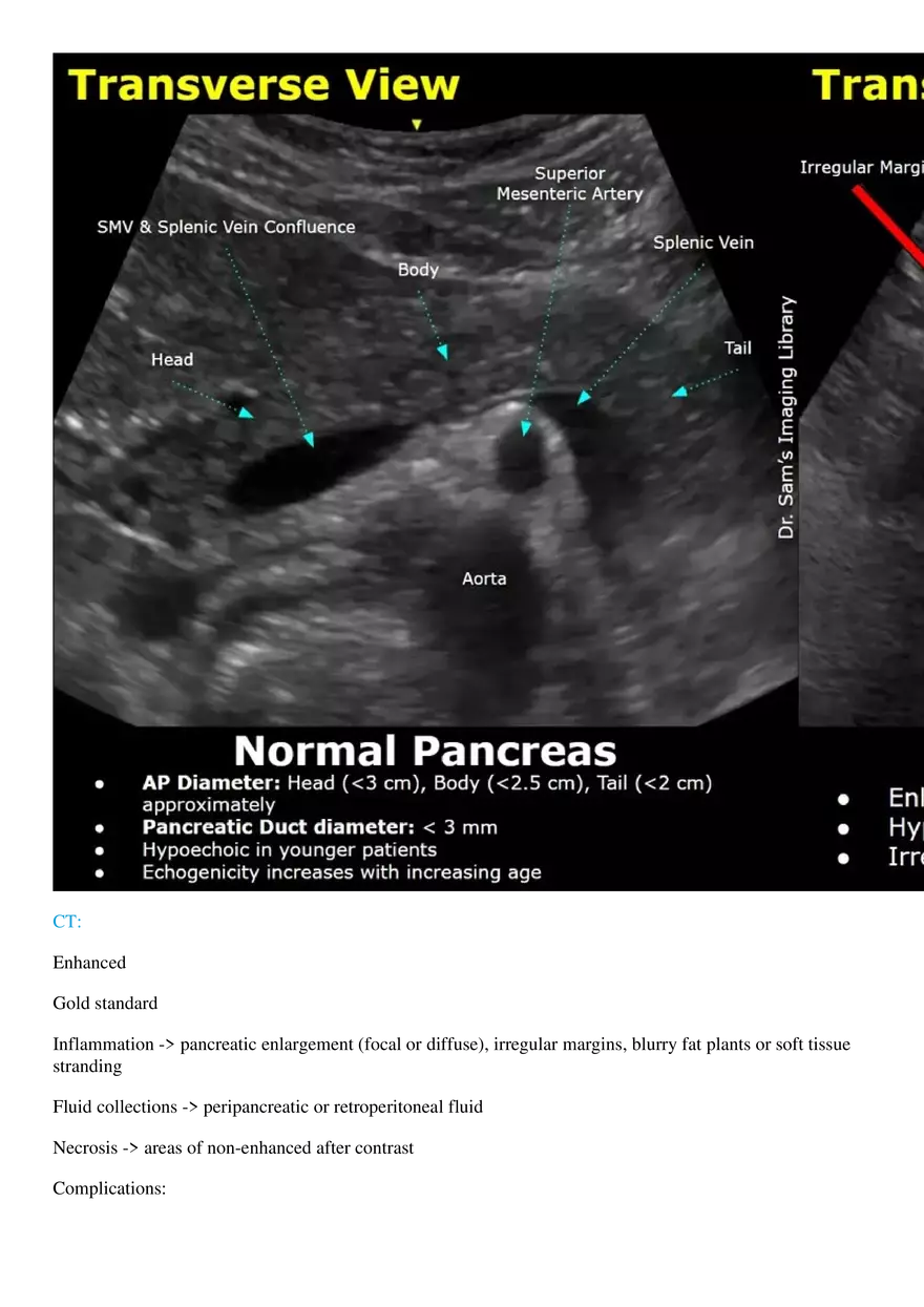 Acute Pancreatitis - Page 4